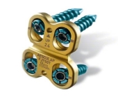 Anterior Cervical Plating System